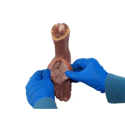 Model próbki patologii stopy